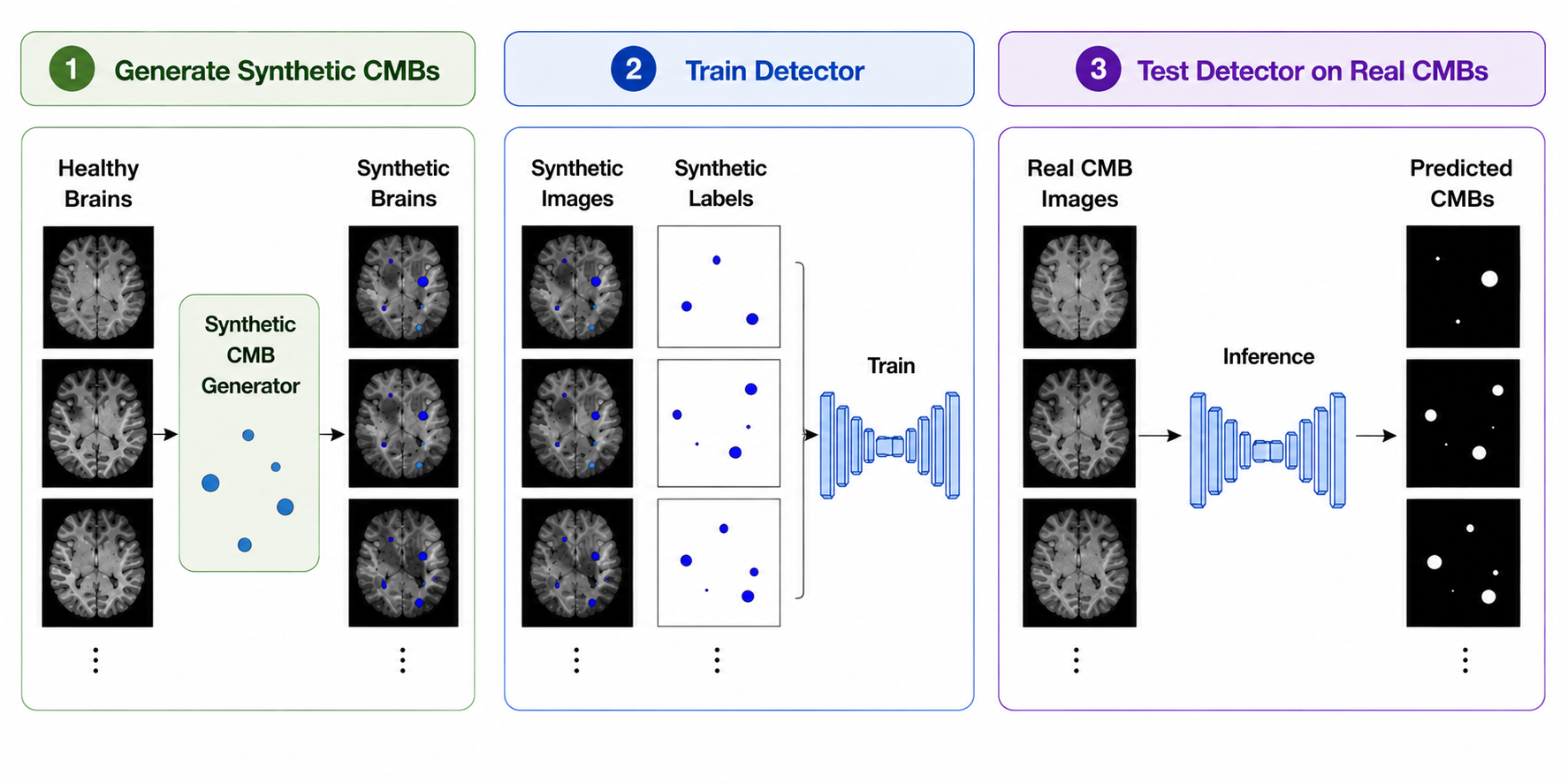 Overview of the synthetic-to-real CMB detection framework
